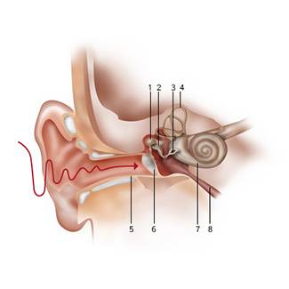 <p>The human hearing system enables us to perceive pressure fluctuations in the air as tone or noise. These types of vibrations are referred to as sound. When the eardrum is hit by sound waves, their movements are transmitted to the cochlea through the auditory ossicles known as the hammer, anvil and stirrup. The cochlea is a coiled part of the inner ear, a pea-sized structure which contains around 25,000 tiny sensory hairs suspended in fluid. These sensory hairs convert sound vibrations into bioelectric signals in the cochlea. In this way, sound waves are converted into sounds of the sea, language or symphonies.</p>
<p><strong>Legend</strong><br />1. Hammer, 2. Anvil, 3. Stirrup, 4. Semicircular canals of the organ of equilibrium, 5. External auditory canal, 6. Eardrum, 7. Cochlea, 8. Eustachian tube</p>